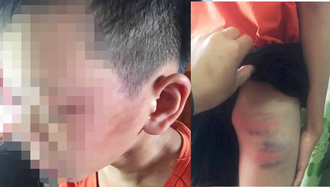 mẹ kế nghi bạo hành con chồng ảnh 1 me ke nghi bao hanh con chong anh 1