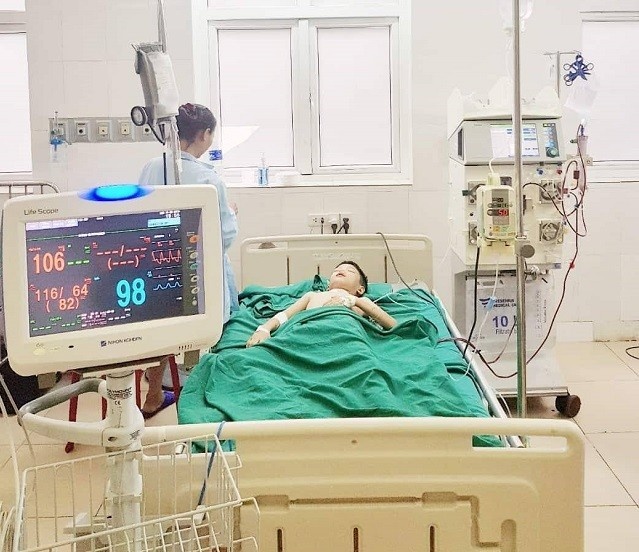 ong đốt  ảnh 1 ong dot anh 1
