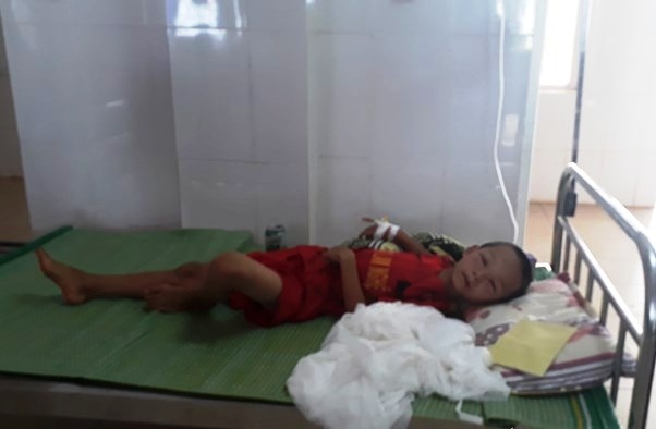 Be trai lop 3 bi ong vo ve dot phai nhap vien cap cuu hinh anh