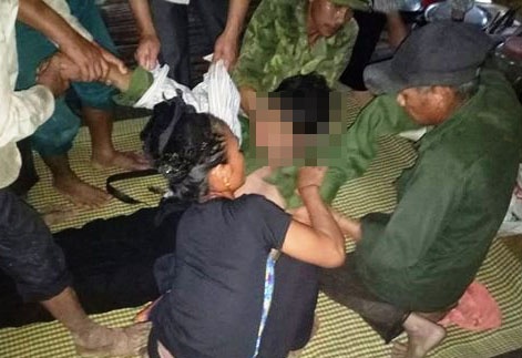 Nguoi dan ong bi set danh tu vong khi cat lua tren dong hinh anh