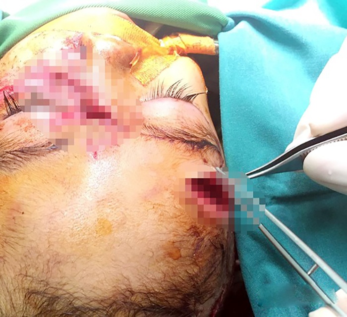 chó tấn công ảnh 1 cho tan cong anh 1