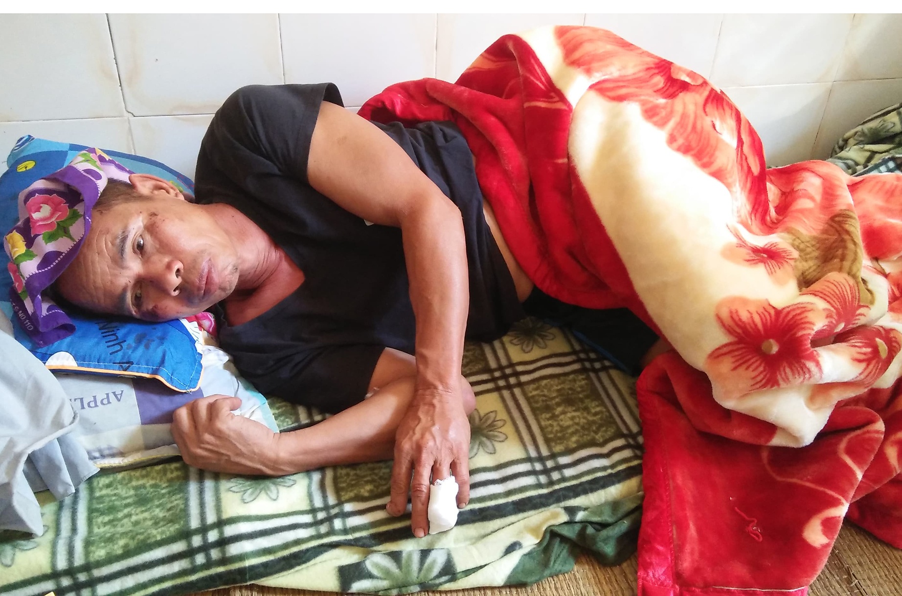 Nguoi dan ong 63 tuoi bi lon rung can trong thuong hinh anh