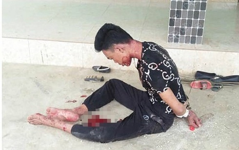 Loi khai cua nghi pham sat hai vo truoc mat con hinh anh