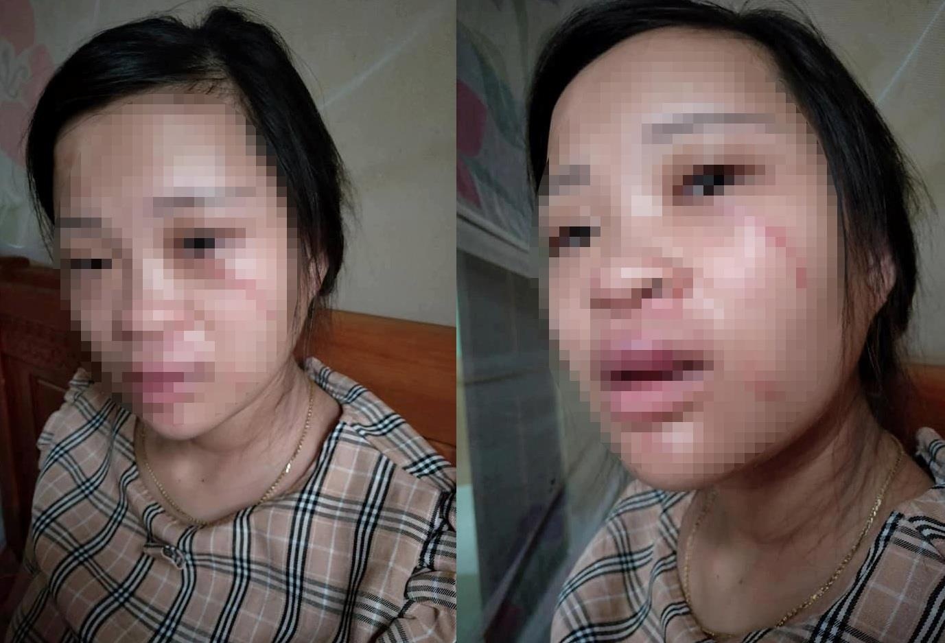 chồng hành hung vợ vì mua hàng trên mạng ảnh 1 chong hanh hung vo vi mua hang tren mang anh 1