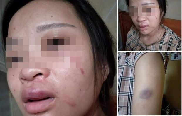 Chong danh vo sap sinh vi mua giay 135.000 dong tren mang hinh anh