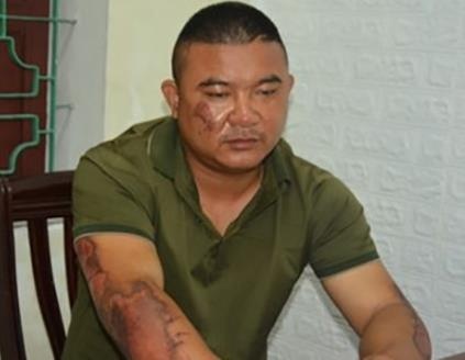 Khoi to ke dung xang phong hoa nha nguoi tinh lam 5 nguoi nhap vien hinh anh