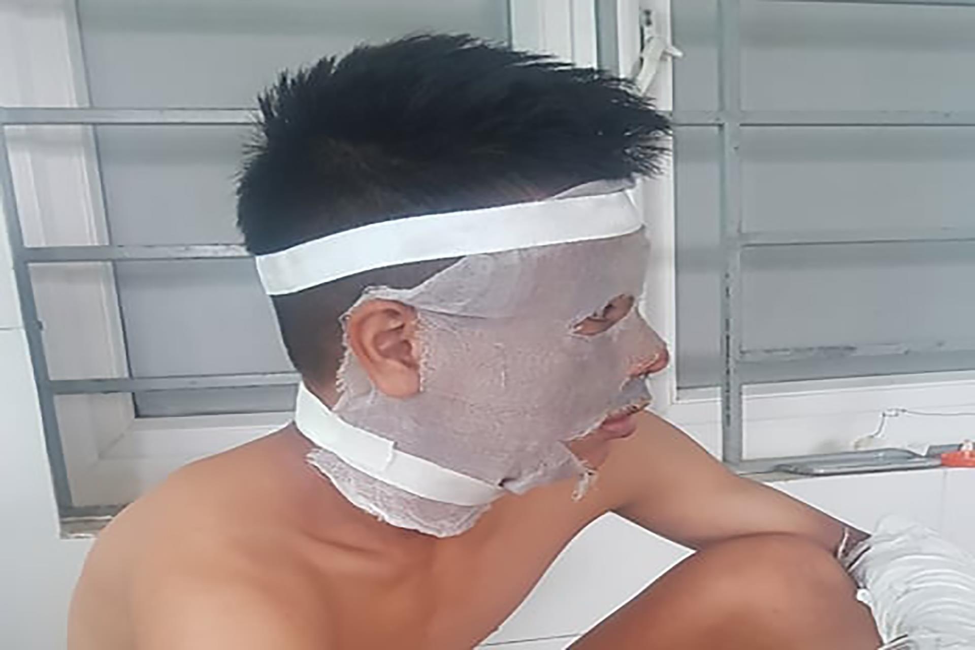 Chum bong bay phat no, 3 cau thu U14 Song Lam Nghe An nhap vien hinh anh