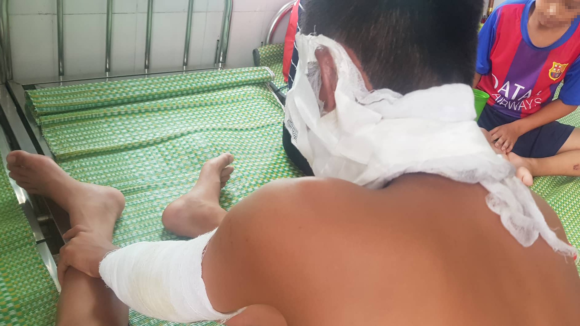 bóng bay phát nổ ảnh 1 bong bay phat no anh 1