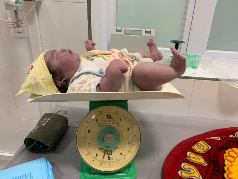 Sinh con nặng 5, 5 kg ảnh 2 Sinh con nang 5, 5 kg anh 2