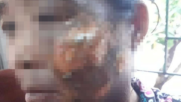 Mau thuan tu mam com, chong hat nuoc soi vao mat vo hinh anh