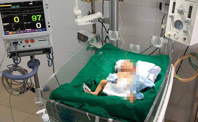 Cuu tre bi di tat bam sinh khien toan bo noi tang loi ra ngoai hinh anh