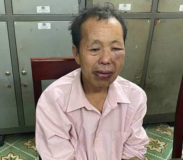 một chiến sĩ hy sinh khi truy bắt tội phạm ma túy ảnh 1 mot chien si hy sinh khi truy bat toi pham ma tuy anh 1