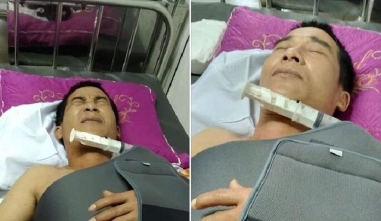 chém gãy xương ảnh 1 chem gay xuong anh 1