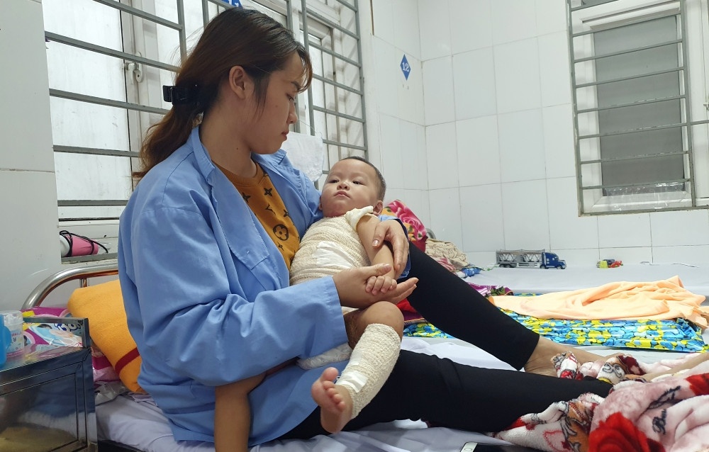 chữa bỏng ảnh 1 chua bong anh 1