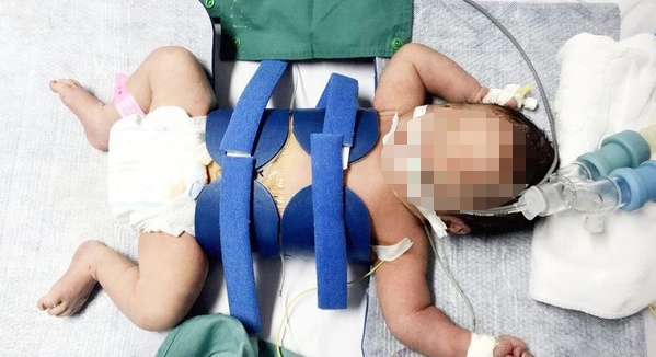 Cuu song tre so sinh anh 1