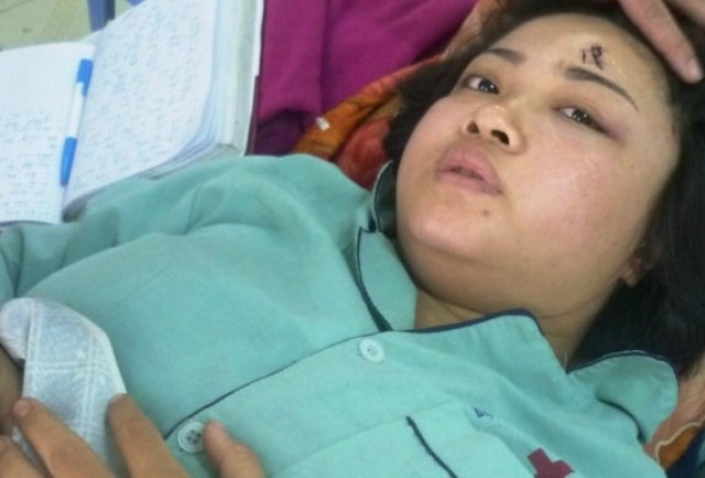 Bao ve danh nu nhan vien tiep thi nut so nao hinh anh