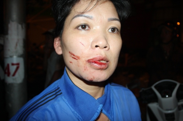 Tai xe o to danh guc mot phu nu vi va cham giao thong hinh anh