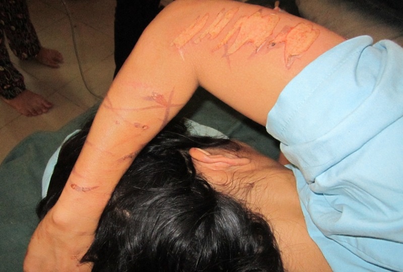 Tam giu 3 nghi pham tra tan mot phu nu nhu thoi trung co hinh anh