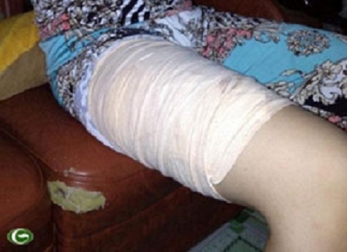 Them mot nu sinh bi ke benh hoan dam vao mong hinh anh