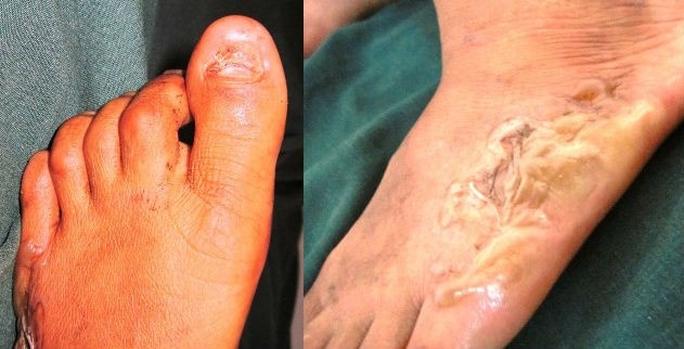 Những vết thương ở chân của nạn nhân.