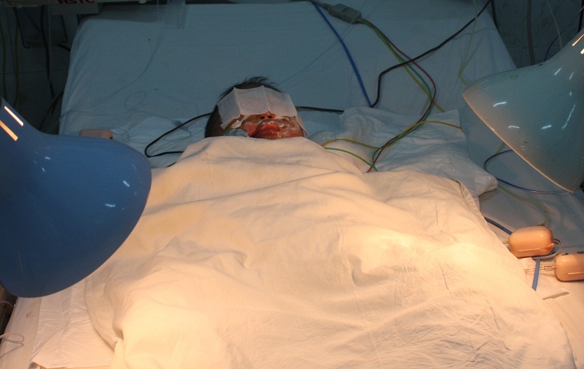 Theo các bác sĩ, cháu Hóa hiện vẫn đang nguy kịch.