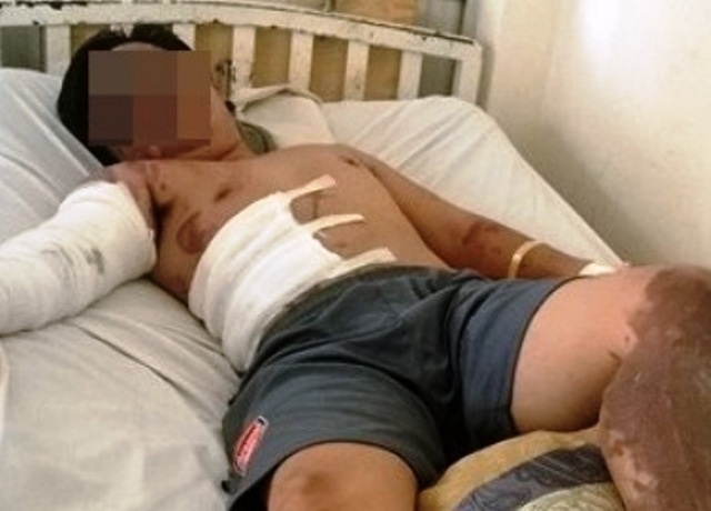 Tat nuoc soi vao mat ban nhau vi chup anh con gai minh hinh anh