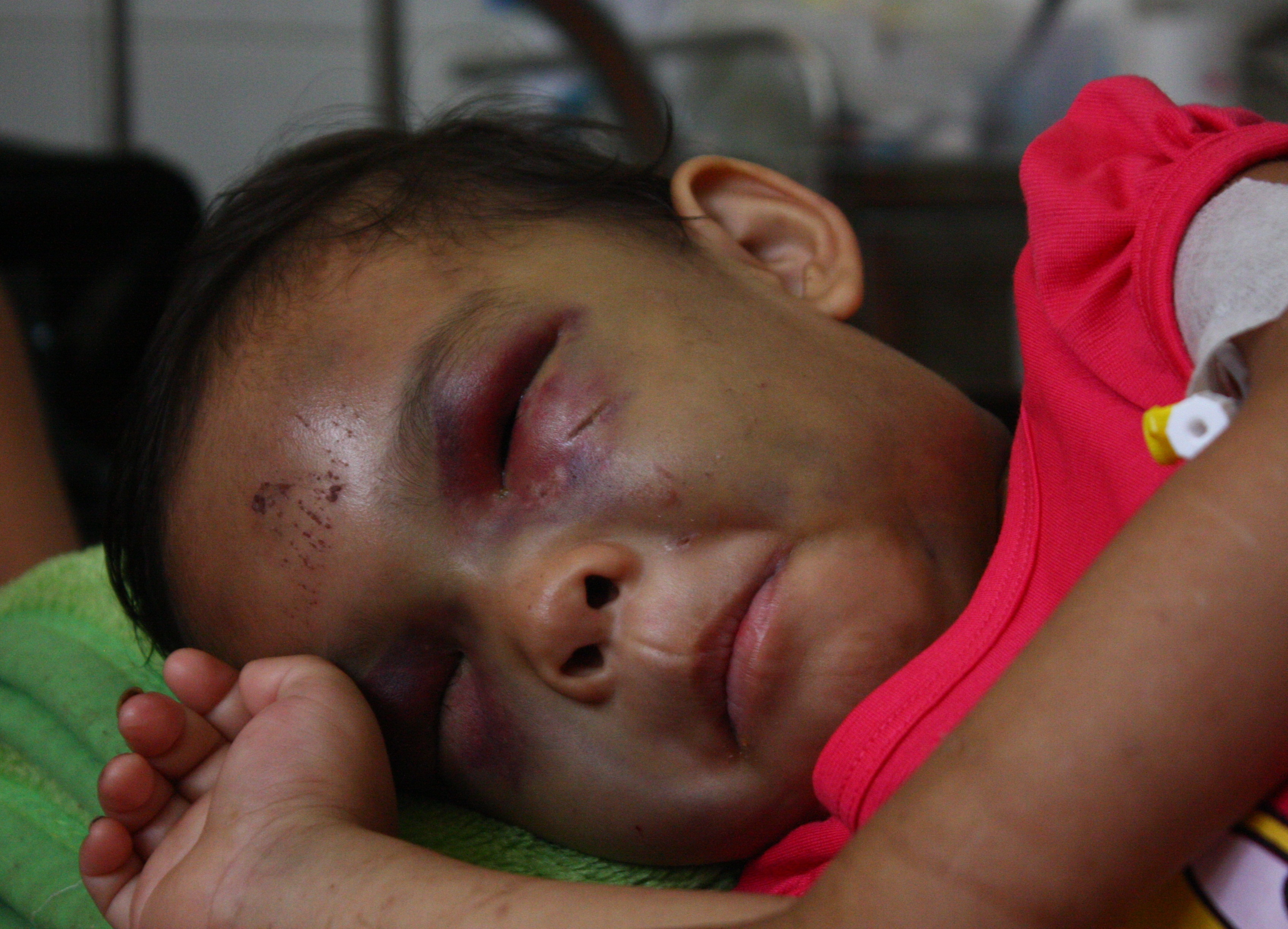 Xot xa khi thay be 4 tuoi bi cha me danh da man hinh anh