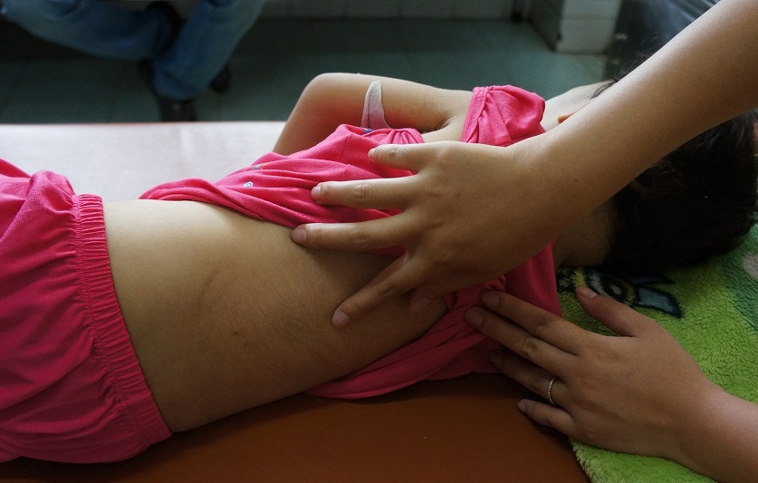 Phía sau lưng của bé gái vẫn nhiều vết thương bị đánh.