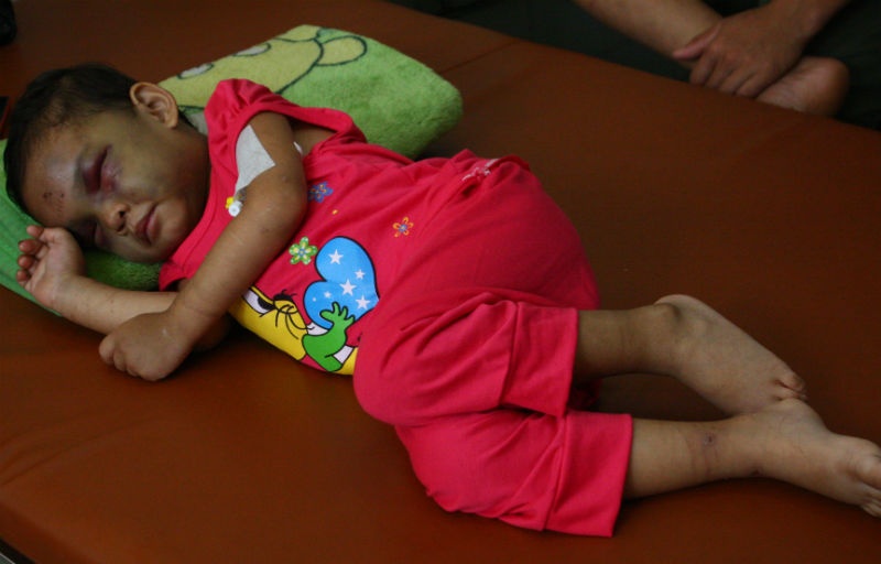 Sau nhiều ngày đau đơn, đứa trẻ mới được một giấc ngủ nhưng vẫn ám ảnh bởi những trận đòn của cha mẹ.