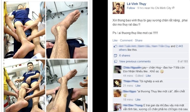 Tối 9/7, siêu mẫu Vĩnh Thụy khiến nhiều khán giả lo lắng khi đọc được dòng thông báo Qua những tấm hình được đăng tải, người hâm mộ càng thêm sốt sắng vì chấn thương của Vĩnh Thụy được xếp vào loại rất nặng, cần thời gian dài điều trị và phục hồi. Lý do khiến anh bị gãy chân là do những va chạm trong một trận đấu bóng vào chiều cùng ngày. Bạn bè thân thiết của siêu mẫu đã thay anh liên tục cập nhật tình hình trên trang cá nhân để gia đình và đặc biệt là mẹ của Vĩnh Thụy biết được tình hình khi bà đang ở xa.anh bị chấn thương rất nặng kèm theo hình ảnh đang nằm trong viện và đang chờ chụp X-quang để chẩn đoán.  