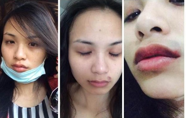 Sao Viet nguoi bi chong danh mat tri, ke tram cam vi bi lua hinh anh