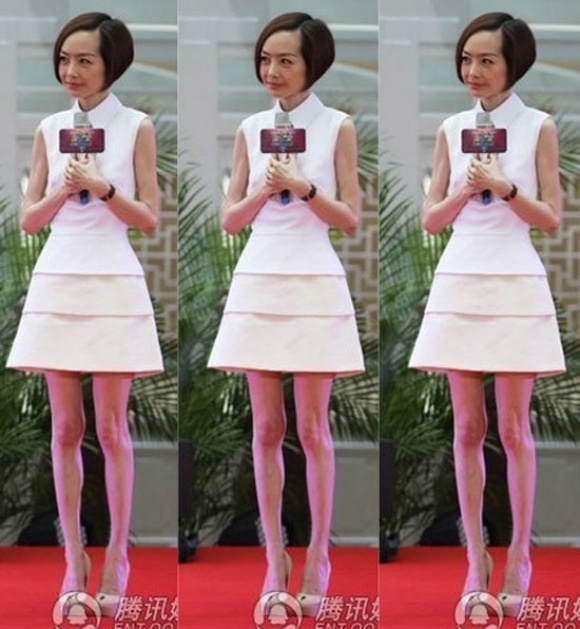 MC hàng đầu Trung Quốc Lỗ Dự có đôi chân chẳng khác gì xương khô.