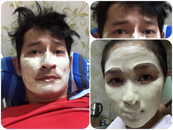 Huy Khánh khoe ảnh đắp mặt nạ ké của bà xã Mạc Anh Thư.