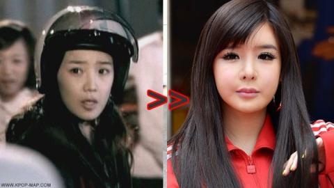 Thành viên đình đám Park Bom của nhóm nhạc nổi tiếng 2NE1 cũng nổi bật trong danh sách này. Khuôn mặt cô thay đổi theo thời gian và đó là điều không ai có thể phủ nhận. Nhiều fan của nữ ca sĩ hiện vẫn tin rằng sở dĩ mặt cô bị sưng là do căn bệnh viêm hạch bạch huyết. Bản thân Park Bom cũng chưa từng thừa nhận việc phẫu thuật thẩm mỹ.