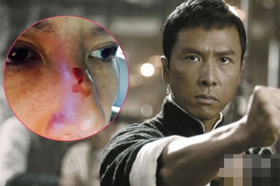 Sao chau A voi nhung tai nan nho doi hinh anh