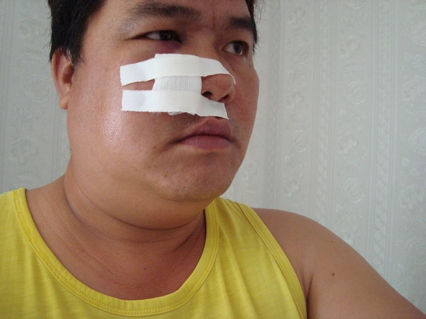 Sao Viet gap nan suyt chet tren phim truong hinh anh