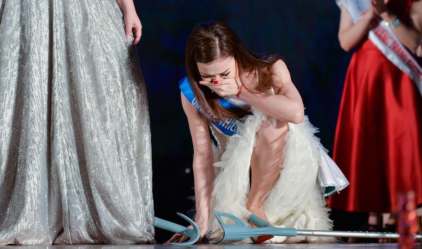 Co gai bi tai nan mat mot chan om mat khong tin minh thanh hoa khoi hinh anh