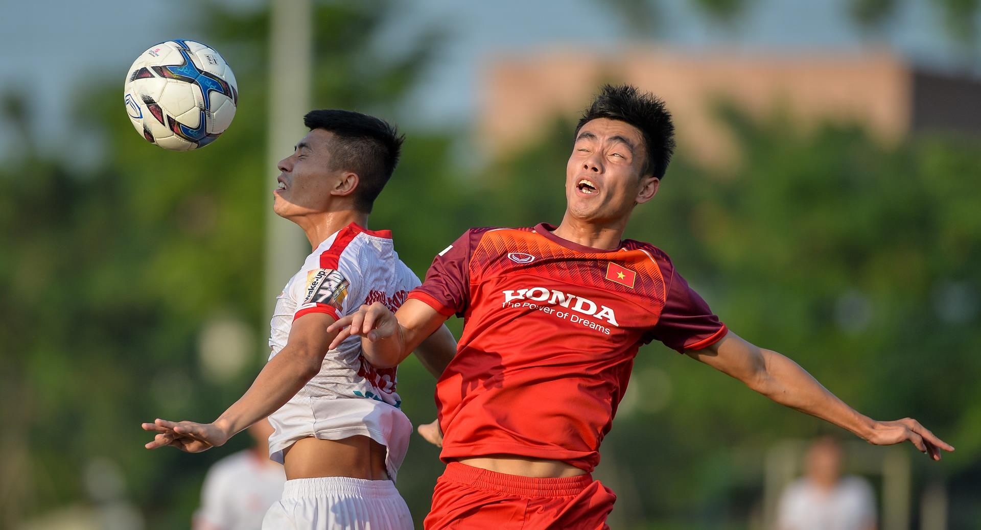 cau thu U23 Viet Nam bi chan thuong anh 2