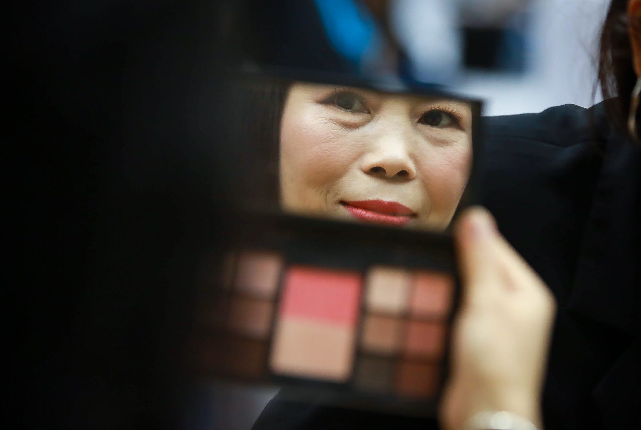 benh nhan tan mau bam sinh anh 2