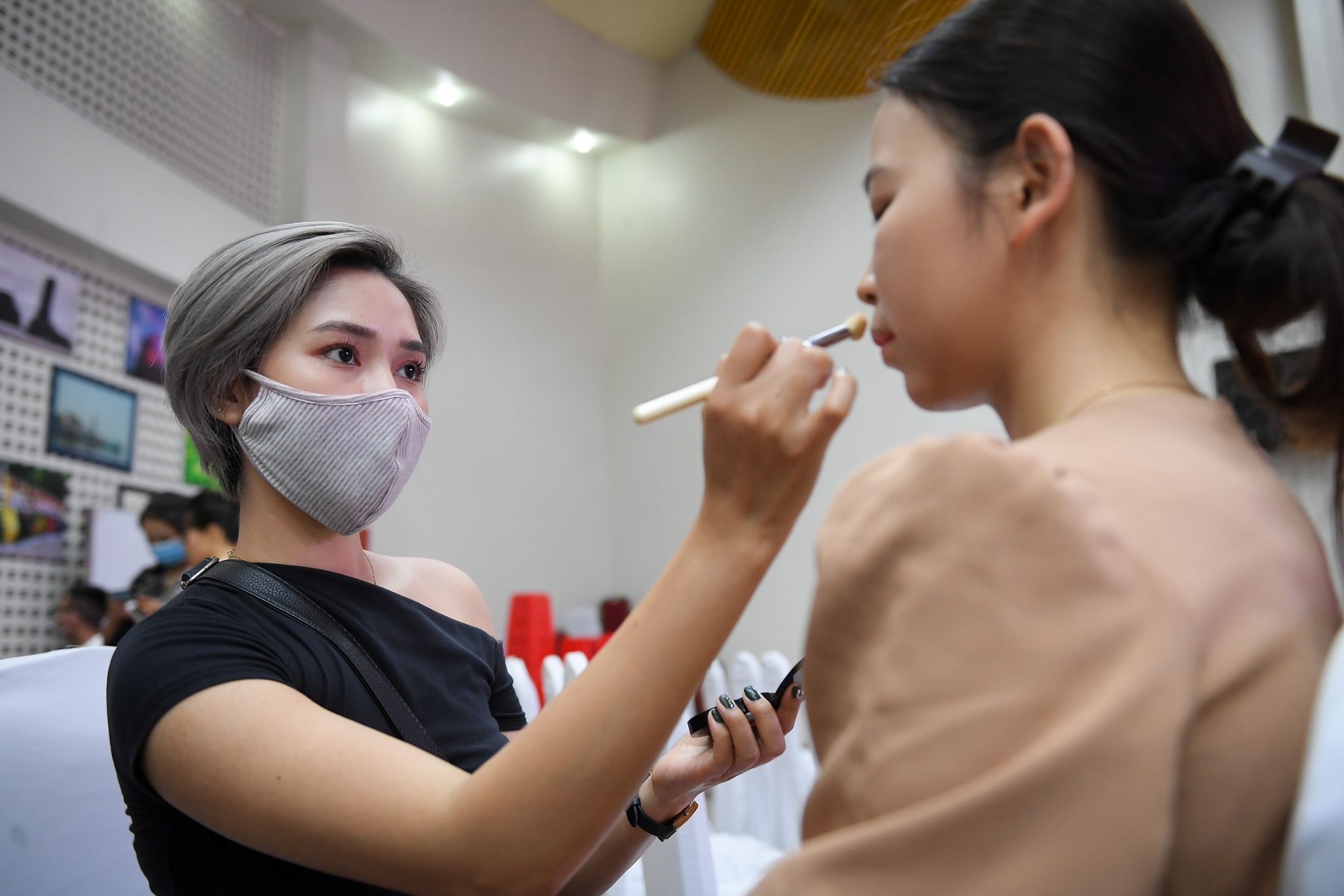 benh nhan tan mau bam sinh anh 6