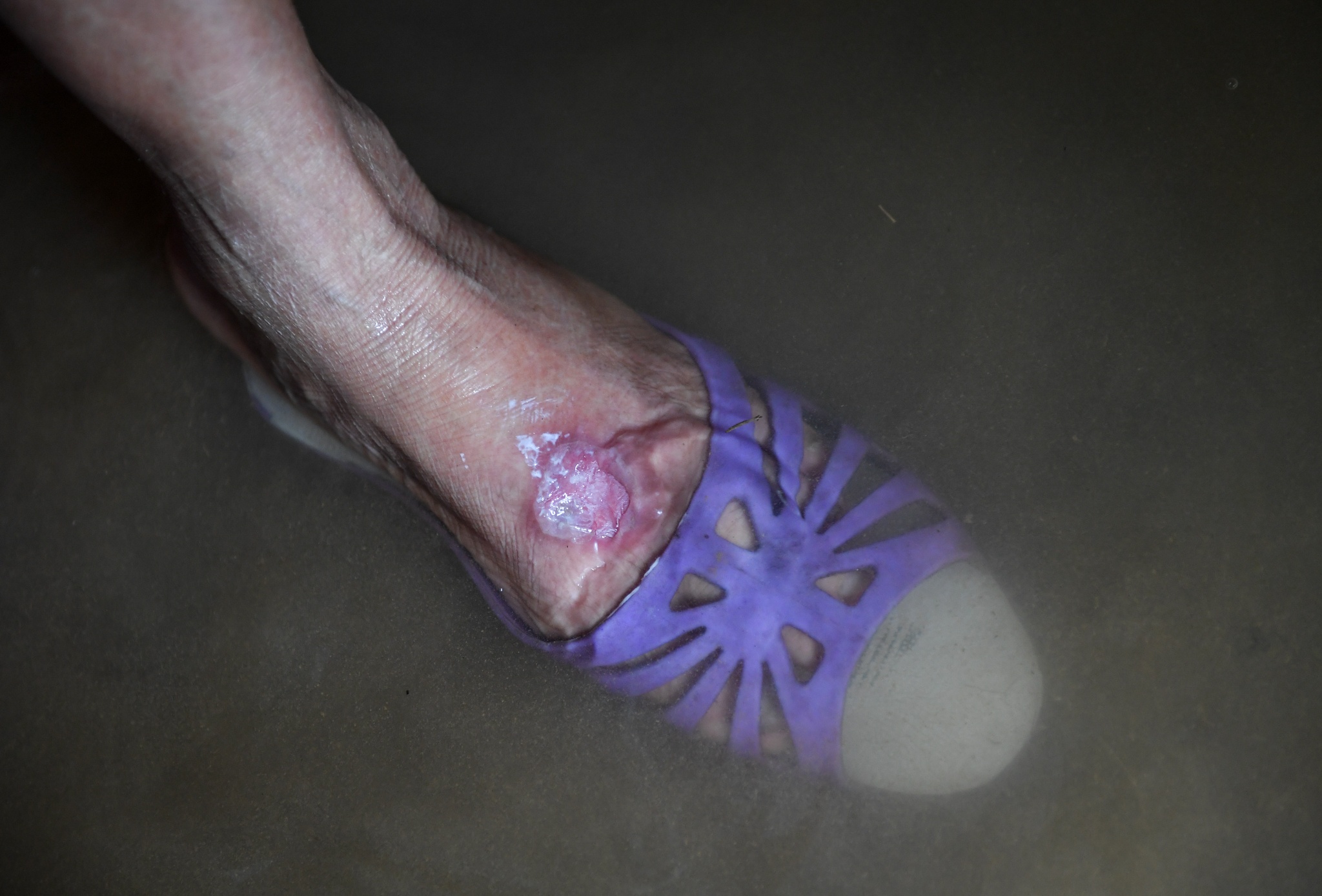 bo song chung voi nguoi trong lu anh 7