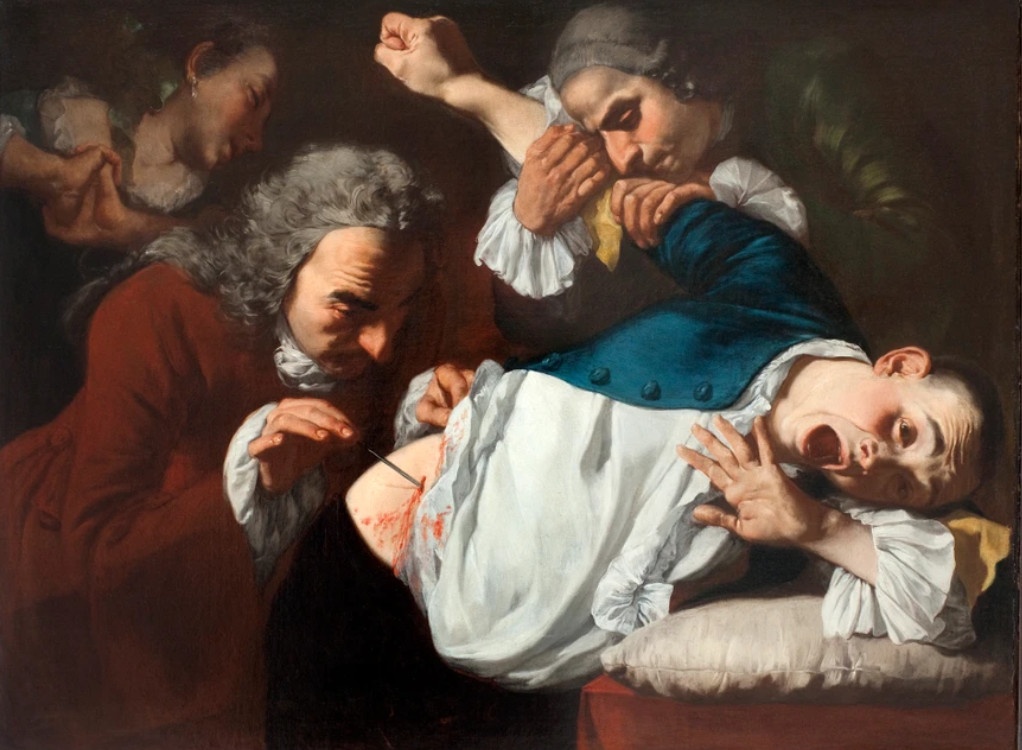 Phau thuat ung thu la noi am anh tu the ky 18 hinh anh