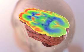 Tieu duong va nguy co Alzheimer hinh anh