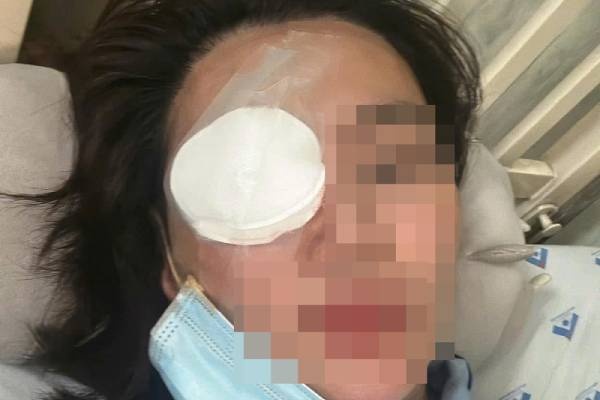 Khoi to ke 'bat ca hai tay', danh guc ban gai o quan khi bi phat hien hinh anh