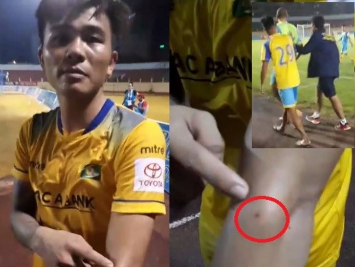 VFF lai ra 'dinh nghia moi' cho loi vi pham cua cau thu o V.League hinh anh