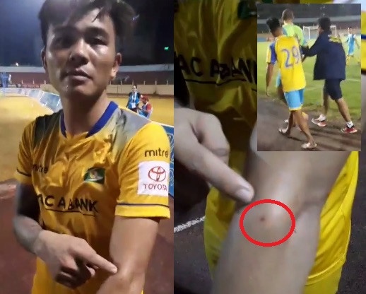 dinh nghia moi' cho loi vi pham anh 1