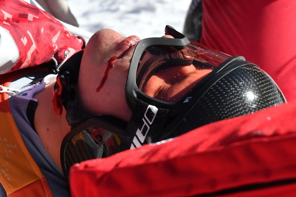 VDV truot tuyet Nga gap tai nan tai Olympic hinh anh