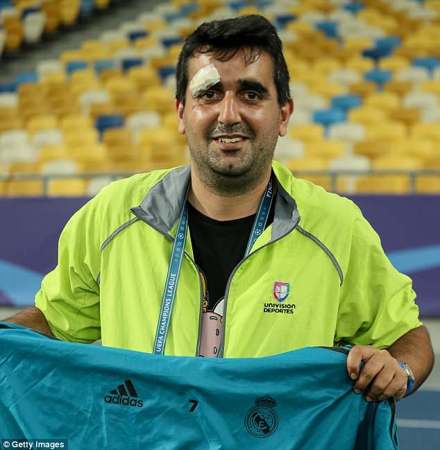 Sut u dau phong vien,  Ronaldo tang ao dau xin loi anh 1