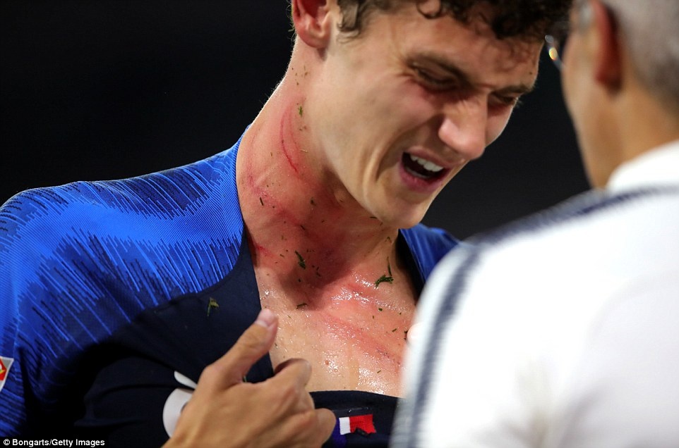 Gundogan bị la ó ảnh 11 Gundogan bi la o anh 11