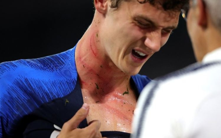 Tru cot tuyen Phap dau don sau khi bi doi thu giam len co hinh anh